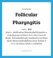 ซาง ภาษาอังกฤษ?, คำศัพท์ภาษาอังกฤษ ซาง แปลว่า follicular pharyngitis ประเภท N ตัวอย่าง เด็กที่น้ำหนักลด มีไข้และท้องเสียเรื้อรังโดยไม่ทราบสาเหตุ ลิ้นและช่องปากเป็นซาง ฝ้าขาว เรียกว่าระยะอาร์ค เพิ่มเติม ชื่อโรคชนิดหนึ่งตามตำราแพทย์แผนโบราณว่าเป็นแก่เด็กเล็ก มีลักษณะเกิดเป็นเม็ดขึ้นในปากในคอ ลิ้นเป็นฝ้า มีอาการ เช่น ไม่กินนม ไม่กินข้าว ปวดหัวตัวร้อน หมวด N