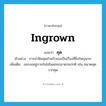 คุด ภาษาอังกฤษ?, คำศัพท์ภาษาอังกฤษ คุด แปลว่า ingrown ประเภท ADJ ตัวอย่าง การผ่าฟันคุดสำหรับเธอเป็นเรื่องที่ยิ่งใหญ่มาก เพิ่มเติม งอกงออยู่ภายในไม่โผล่ออกมาตามปกติ เช่น หนวดคุด รากคุด หมวด ADJ