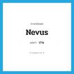 ปาน ภาษาอังกฤษ?, คำศัพท์ภาษาอังกฤษ ปาน แปลว่า nevus ประเภท N หมวด N