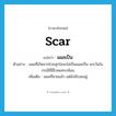 scar แปลว่า?, คำศัพท์ภาษาอังกฤษ scar แปลว่า แผลเป็น ประเภท N ตัวอย่าง แผลที่เกิดจากโรคสุกใสจะไม่เป็นแผลเป็น ยกเว้นในกรณีที่มีโรคแทรกซ้อน เพิ่มเติม แผลที่หายแล้ว แต่ยังมีรอยอยู่ หมวด N