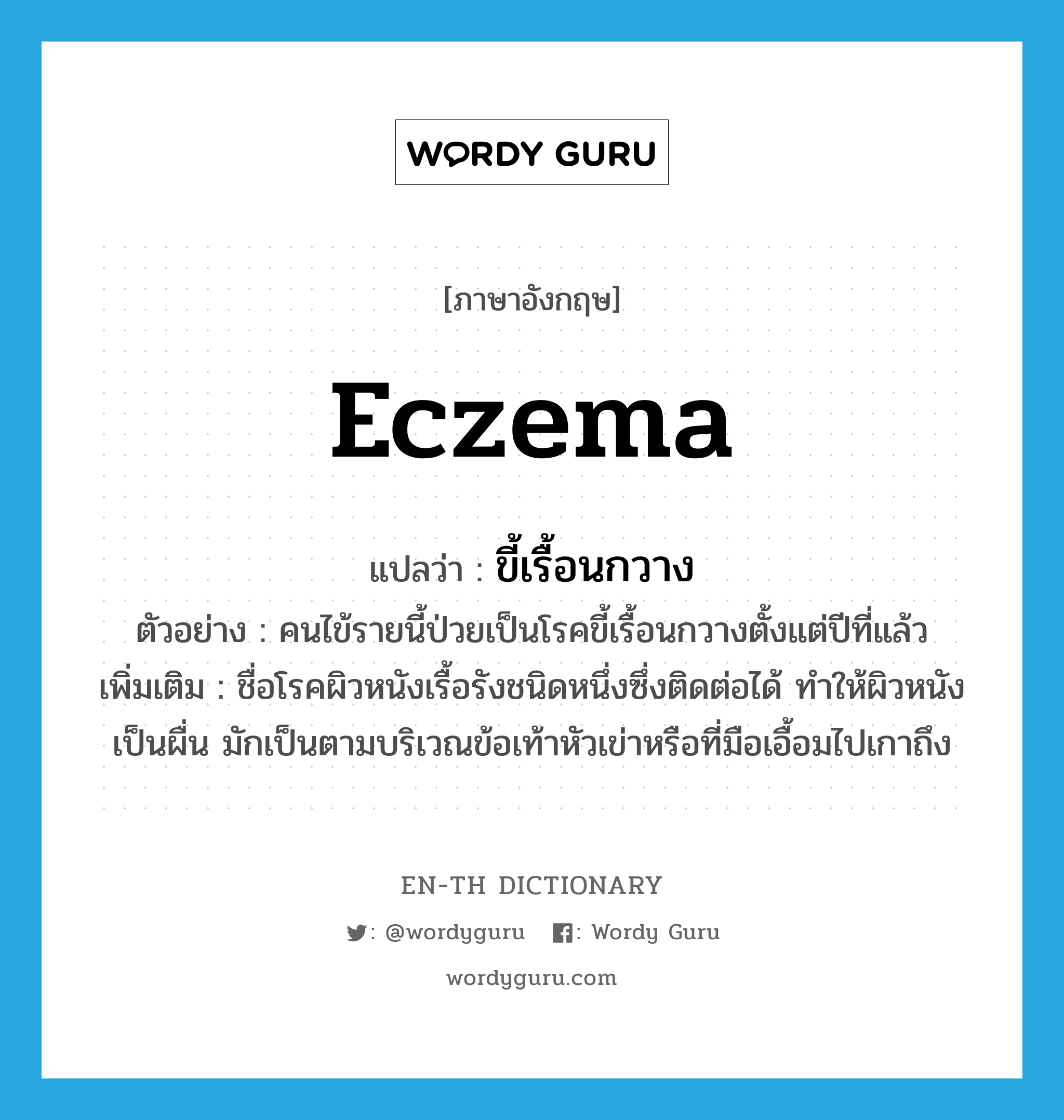 eczema แปลว่า?, คำศัพท์ภาษาอังกฤษ eczema แปลว่า ขี้เรื้อนกวาง ประเภท N ตัวอย่าง คนไข้รายนี้ป่วยเป็นโรคขี้เรื้อนกวางตั้งแต่ปีที่แล้ว เพิ่มเติม ชื่อโรคผิวหนังเรื้อรังชนิดหนึ่งซึ่งติดต่อได้ ทำให้ผิวหนังเป็นผื่น มักเป็นตามบริเวณข้อเท้าหัวเข่าหรือที่มือเอื้อมไปเกาถึง หมวด N