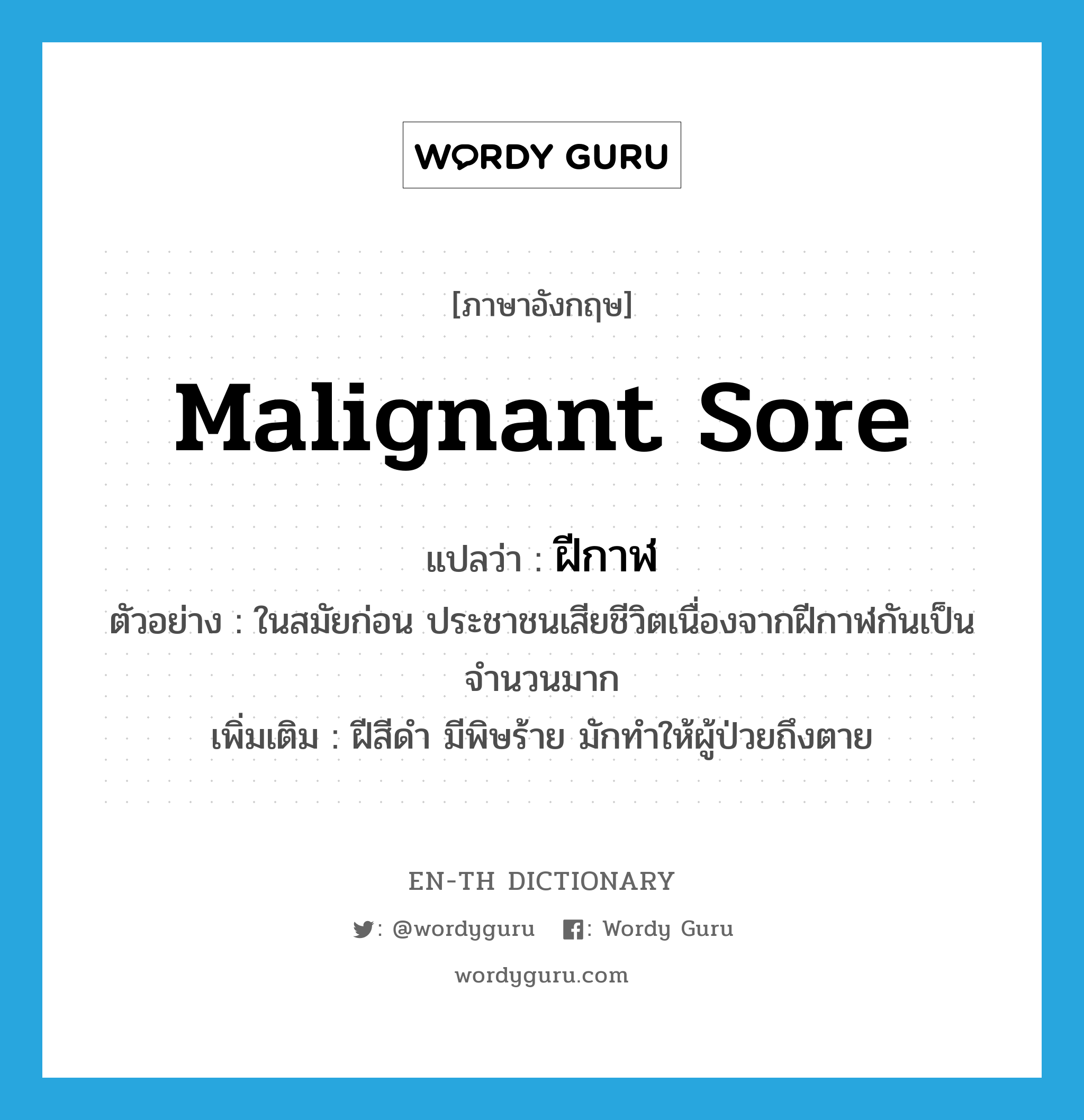 malignant sore แปลว่า?, คำศัพท์ภาษาอังกฤษ malignant sore แปลว่า ฝีกาฬ ประเภท N ตัวอย่าง ในสมัยก่อน ประชาชนเสียชีวิตเนื่องจากฝีกาฬกันเป็นจำนวนมาก เพิ่มเติม ฝีสีดำ มีพิษร้าย มักทำให้ผู้ป่วยถึงตาย หมวด N