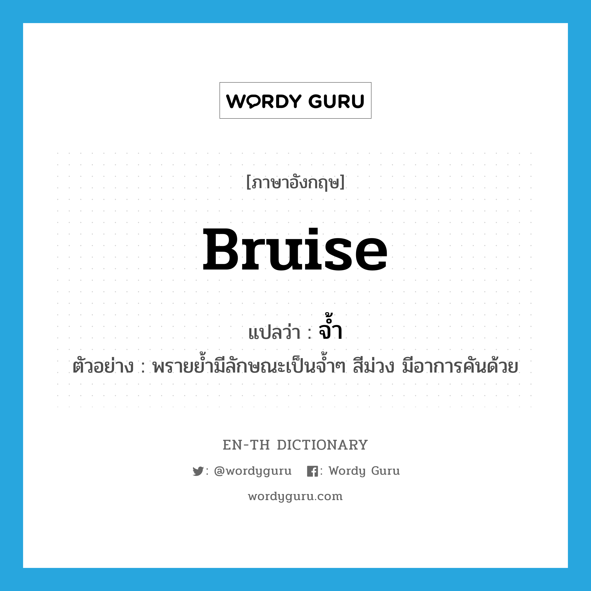 bruise แปลว่า?, คำศัพท์ภาษาอังกฤษ bruise แปลว่า จ้ำ ประเภท N ตัวอย่าง พรายย้ำมีลักษณะเป็นจ้ำๆ สีม่วง มีอาการคันด้วย หมวด N