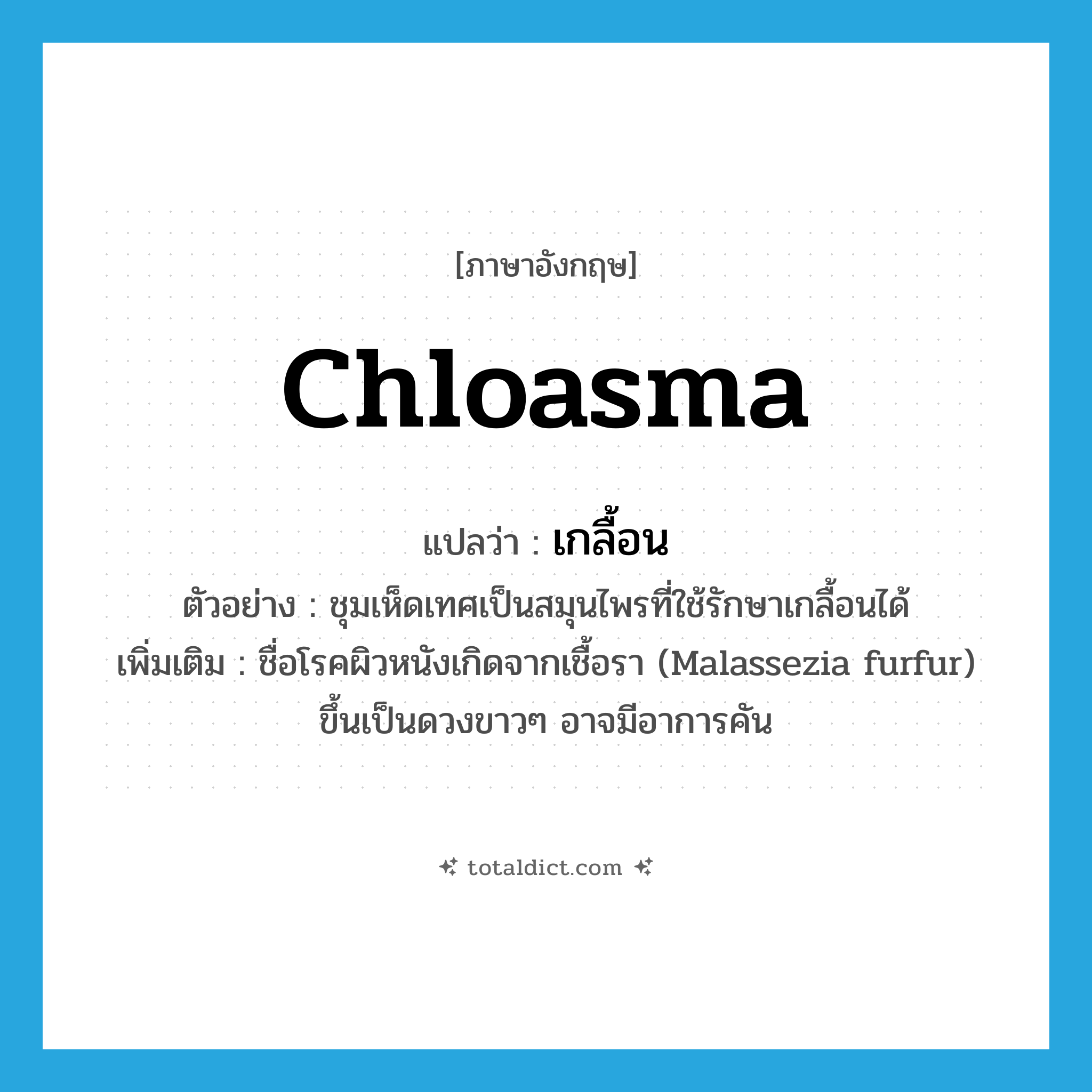 chloasma แปลว่า?, คำศัพท์ภาษาอังกฤษ chloasma แปลว่า เกลื้อน ประเภท N ตัวอย่าง ชุมเห็ดเทศเป็นสมุนไพรที่ใช้รักษาเกลื้อนได้ เพิ่มเติม ชื่อโรคผิวหนังเกิดจากเชื้อรา (Malassezia furfur) ขึ้นเป็นดวงขาวๆ อาจมีอาการคัน หมวด N