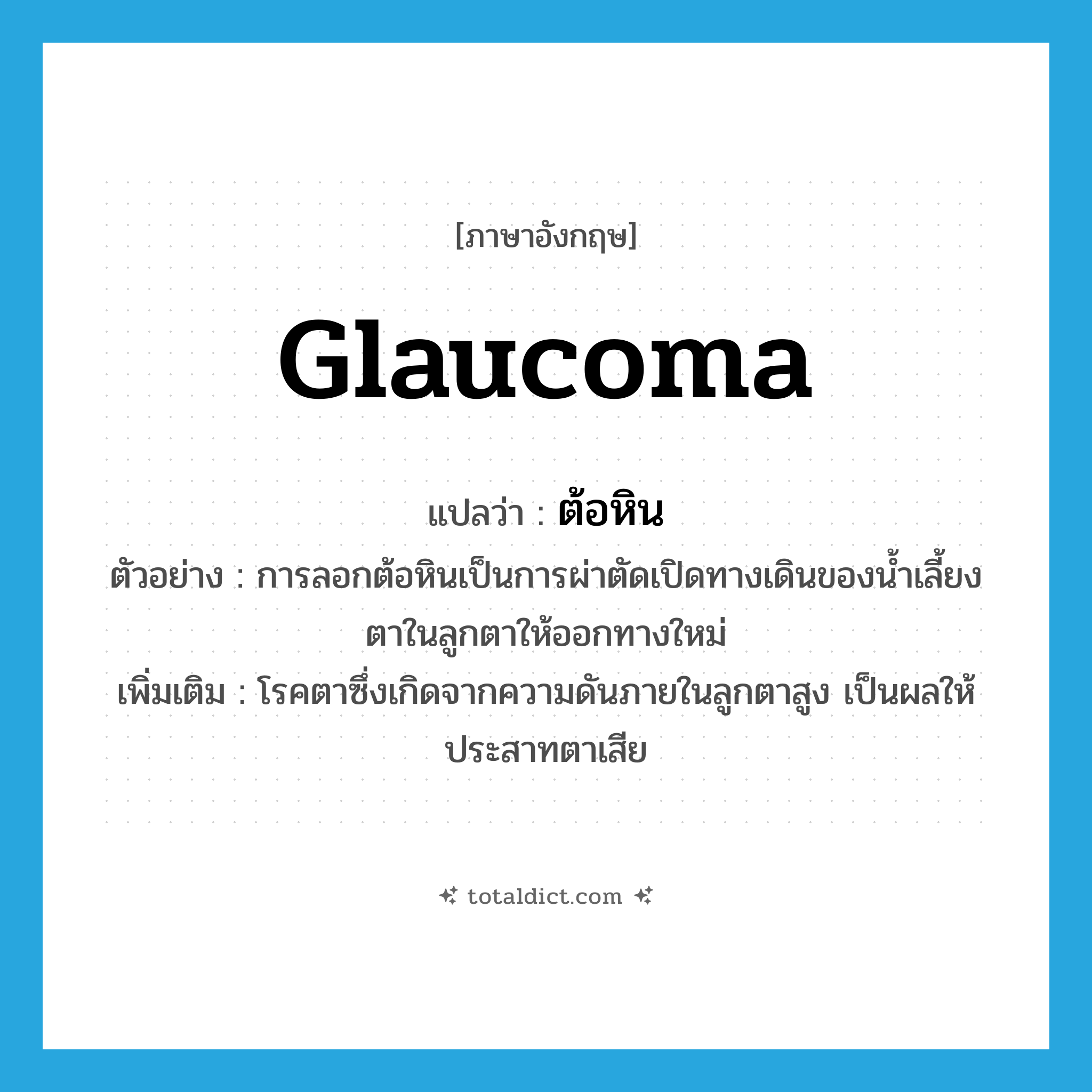 glaucoma แปลว่า?, คำศัพท์ภาษาอังกฤษ glaucoma แปลว่า ต้อหิน ประเภท N ตัวอย่าง การลอกต้อหินเป็นการผ่าตัดเปิดทางเดินของน้ำเลี้ยงตาในลูกตาให้ออกทางใหม่ เพิ่มเติม โรคตาซึ่งเกิดจากความดันภายในลูกตาสูง เป็นผลให้ประสาทตาเสีย หมวด N