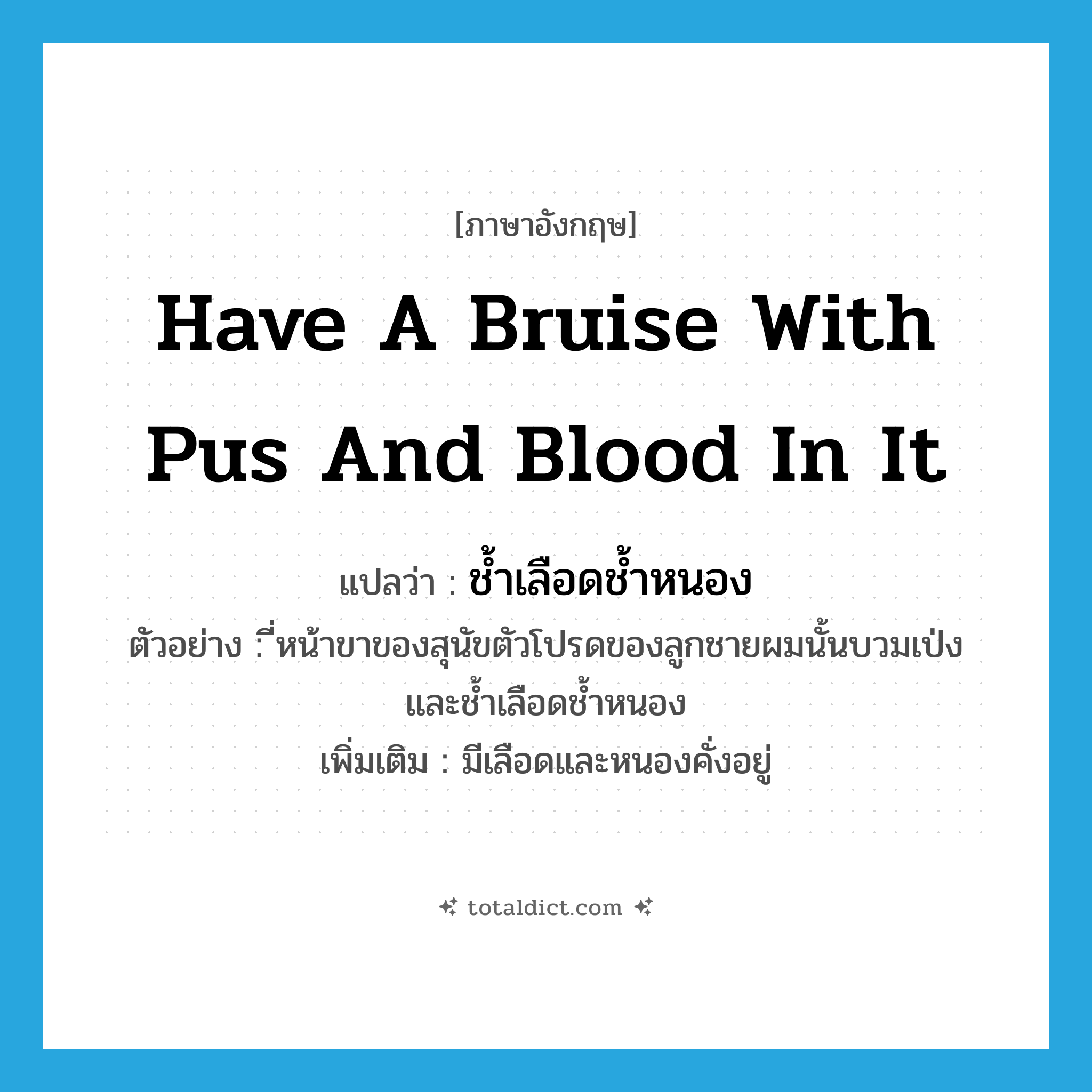 have a bruise with pus and blood in it แปลว่า?, คำศัพท์ภาษาอังกฤษ have a bruise with pus and blood in it แปลว่า ช้ำเลือดช้ำหนอง ประเภท V ตัวอย่าง ี่หน้าขาของสุนัขตัวโปรดของลูกชายผมนั้นบวมเป่ง และช้ำเลือดช้ำหนอง เพิ่มเติม มีเลือดและหนองคั่งอยู่ หมวด V