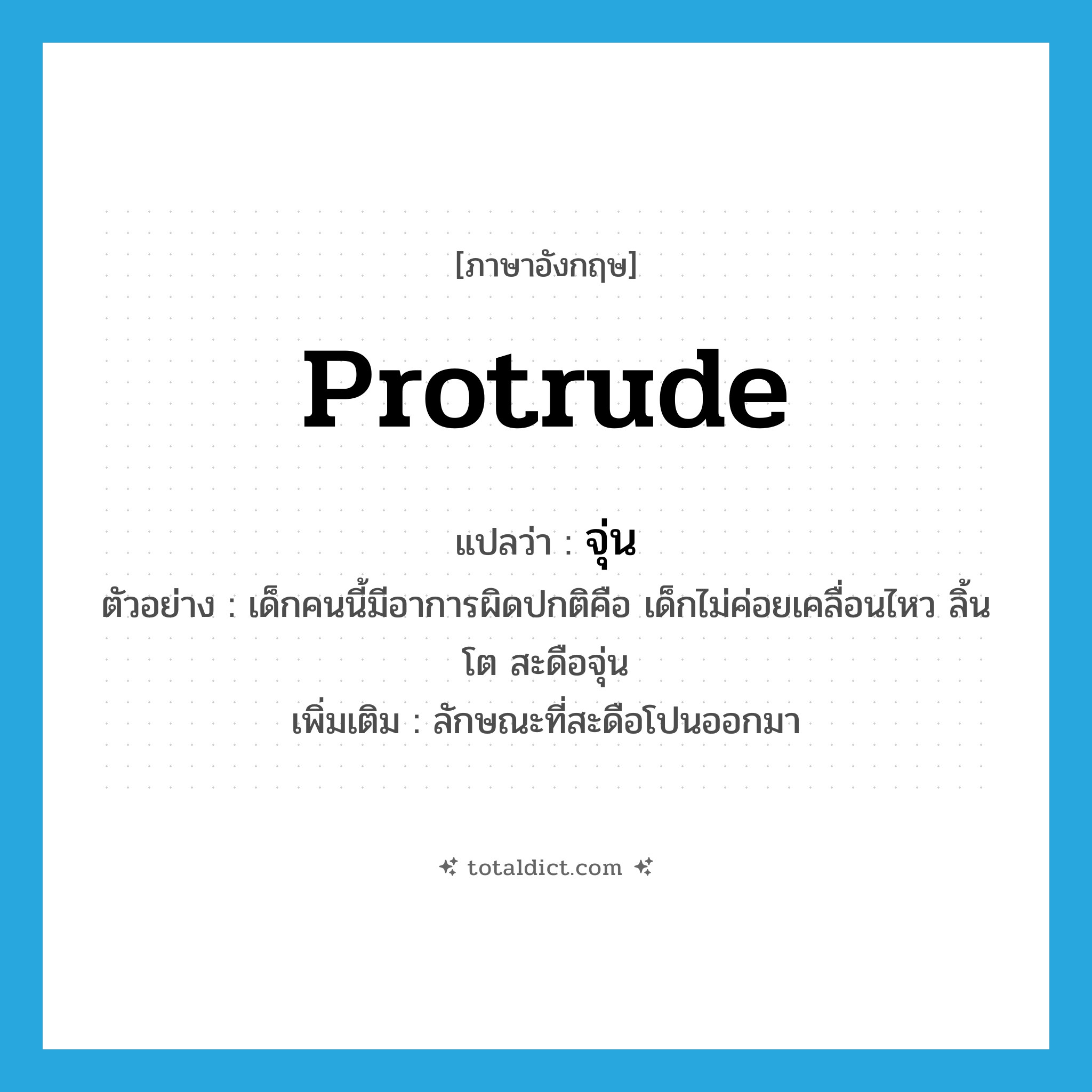 protrude แปลว่า?, คำศัพท์ภาษาอังกฤษ protrude แปลว่า จุ่น ประเภท V ตัวอย่าง เด็กคนนี้มีอาการผิดปกติคือ เด็กไม่ค่อยเคลื่อนไหว ลิ้นโต สะดือจุ่น เพิ่มเติม ลักษณะที่สะดือโปนออกมา หมวด V