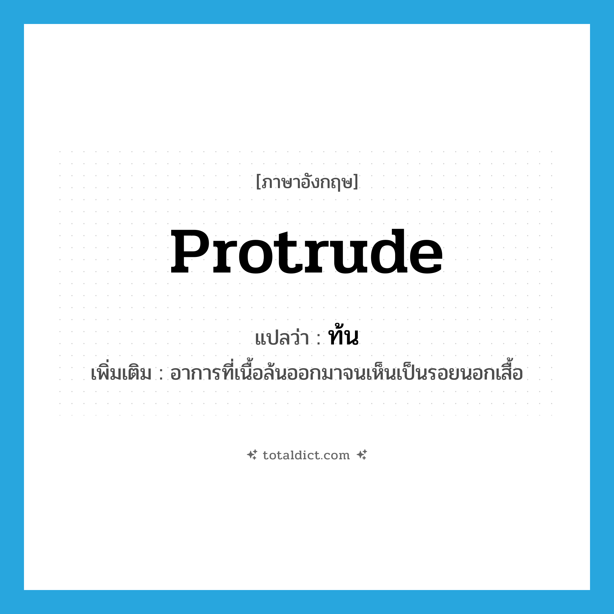 protrude แปลว่า?, คำศัพท์ภาษาอังกฤษ protrude แปลว่า ท้น ประเภท V เพิ่มเติม อาการที่เนื้อล้นออกมาจนเห็นเป็นรอยนอกเสื้อ หมวด V