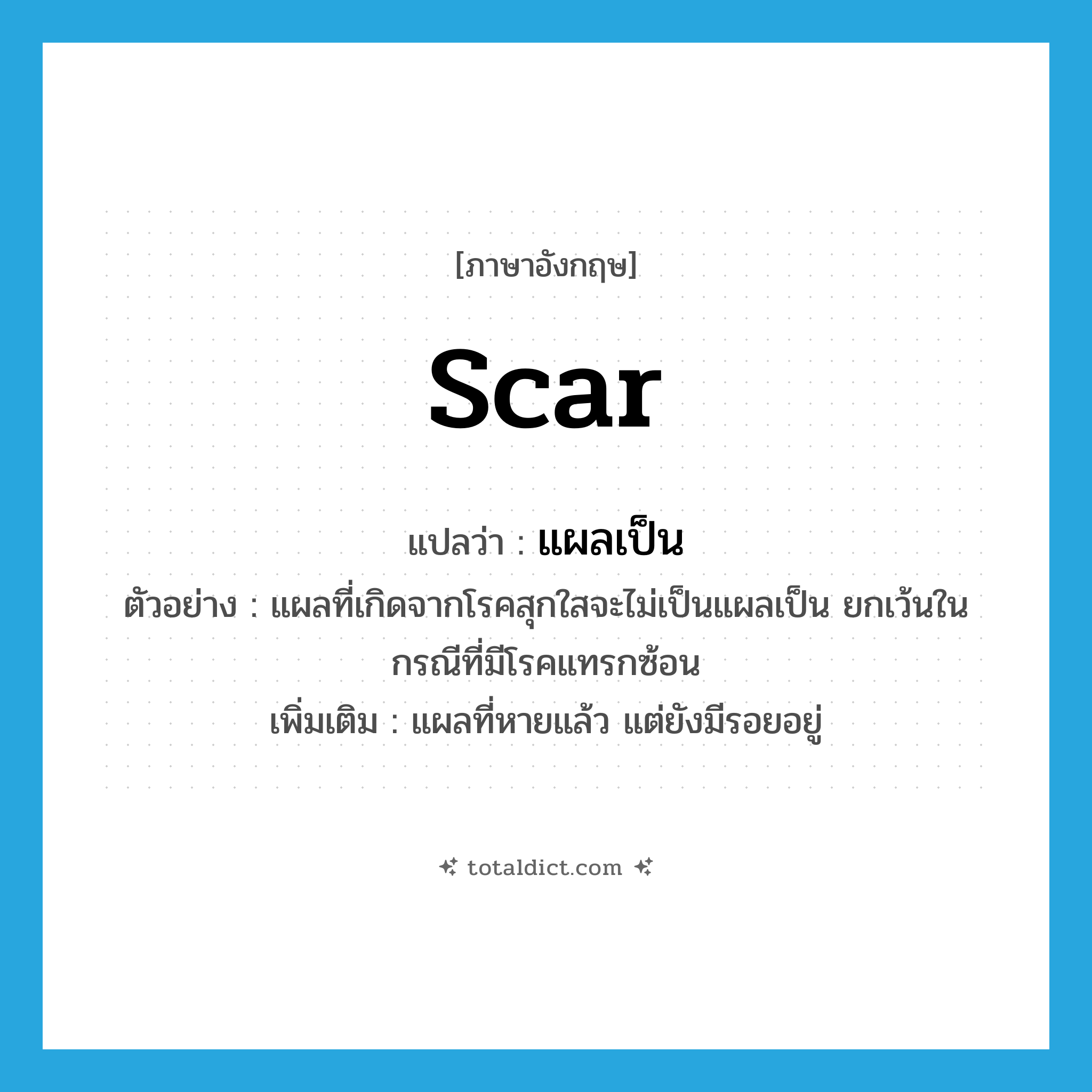 scar แปลว่า?, คำศัพท์ภาษาอังกฤษ scar แปลว่า แผลเป็น ประเภท N ตัวอย่าง แผลที่เกิดจากโรคสุกใสจะไม่เป็นแผลเป็น ยกเว้นในกรณีที่มีโรคแทรกซ้อน เพิ่มเติม แผลที่หายแล้ว แต่ยังมีรอยอยู่ หมวด N