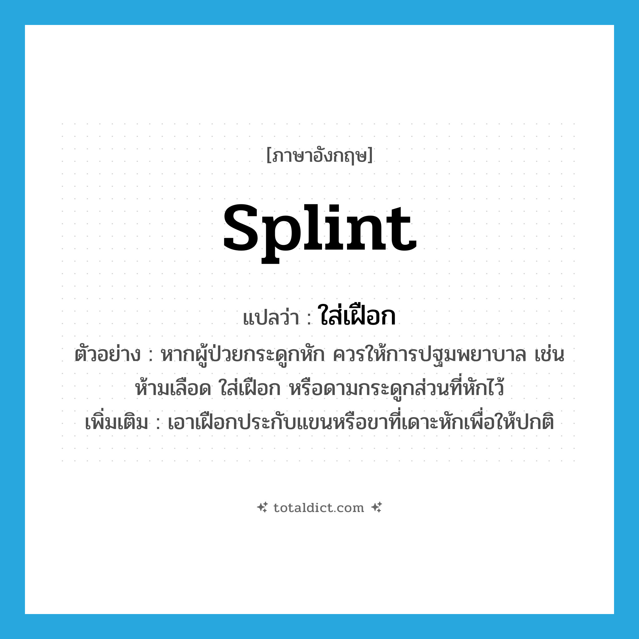 splint แปลว่า?, คำศัพท์ภาษาอังกฤษ splint แปลว่า ใส่เฝือก ประเภท V ตัวอย่าง หากผู้ป่วยกระดูกหัก ควรให้การปฐมพยาบาล เช่น ห้ามเลือด ใส่เฝือก หรือดามกระดูกส่วนที่หักไว้ เพิ่มเติม เอาเฝือกประกับแขนหรือขาที่เดาะหักเพื่อให้ปกติ หมวด V