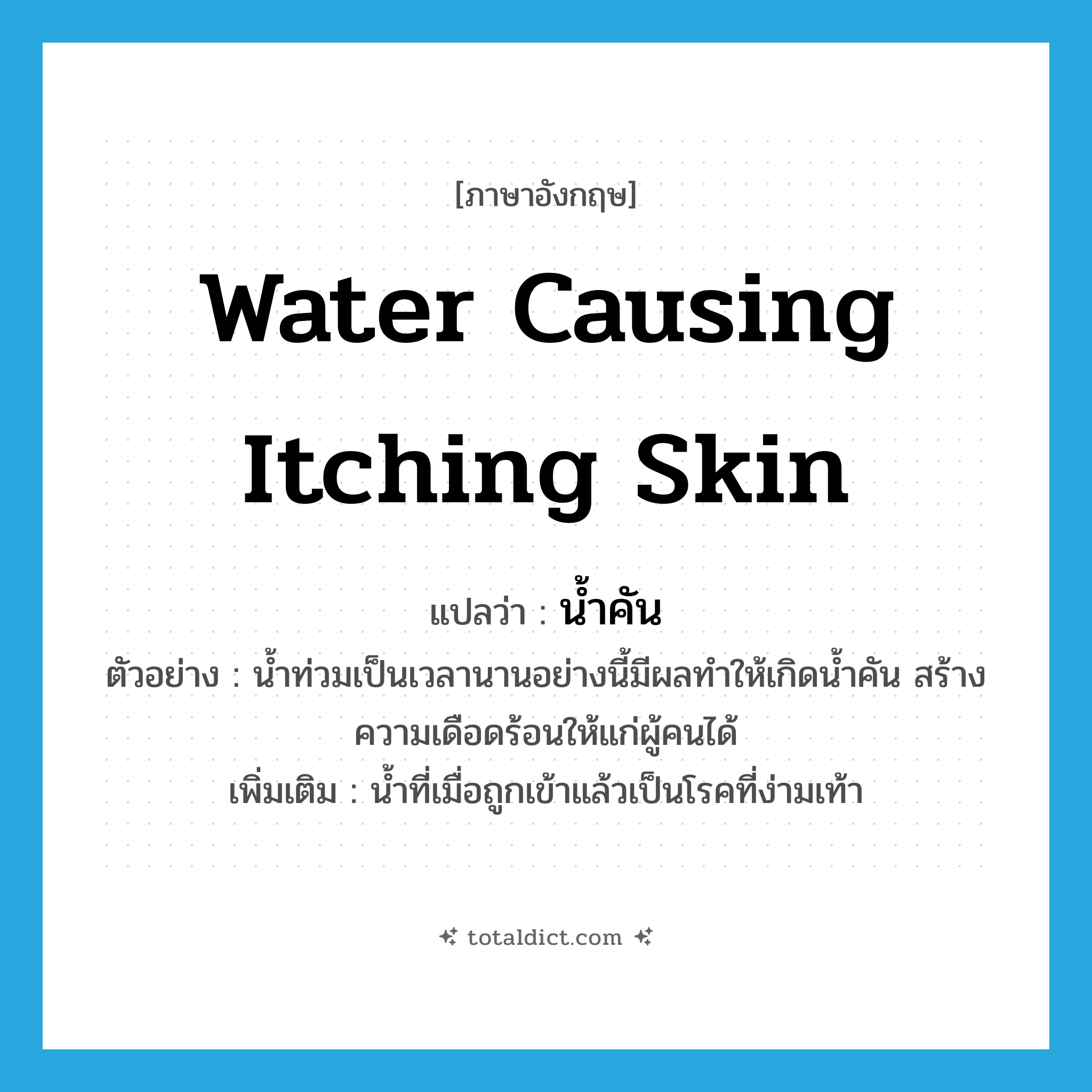 water causing itching skin แปลว่า?, คำศัพท์ภาษาอังกฤษ water causing itching skin แปลว่า น้ำคัน ประเภท N ตัวอย่าง น้ำท่วมเป็นเวลานานอย่างนี้มีผลทำให้เกิดน้ำคัน สร้างความเดือดร้อนให้แก่ผู้คนได้ เพิ่มเติม น้ำที่เมื่อถูกเข้าแล้วเป็นโรคที่ง่ามเท้า หมวด N